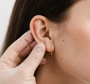 kepçe kulak ameliyatı