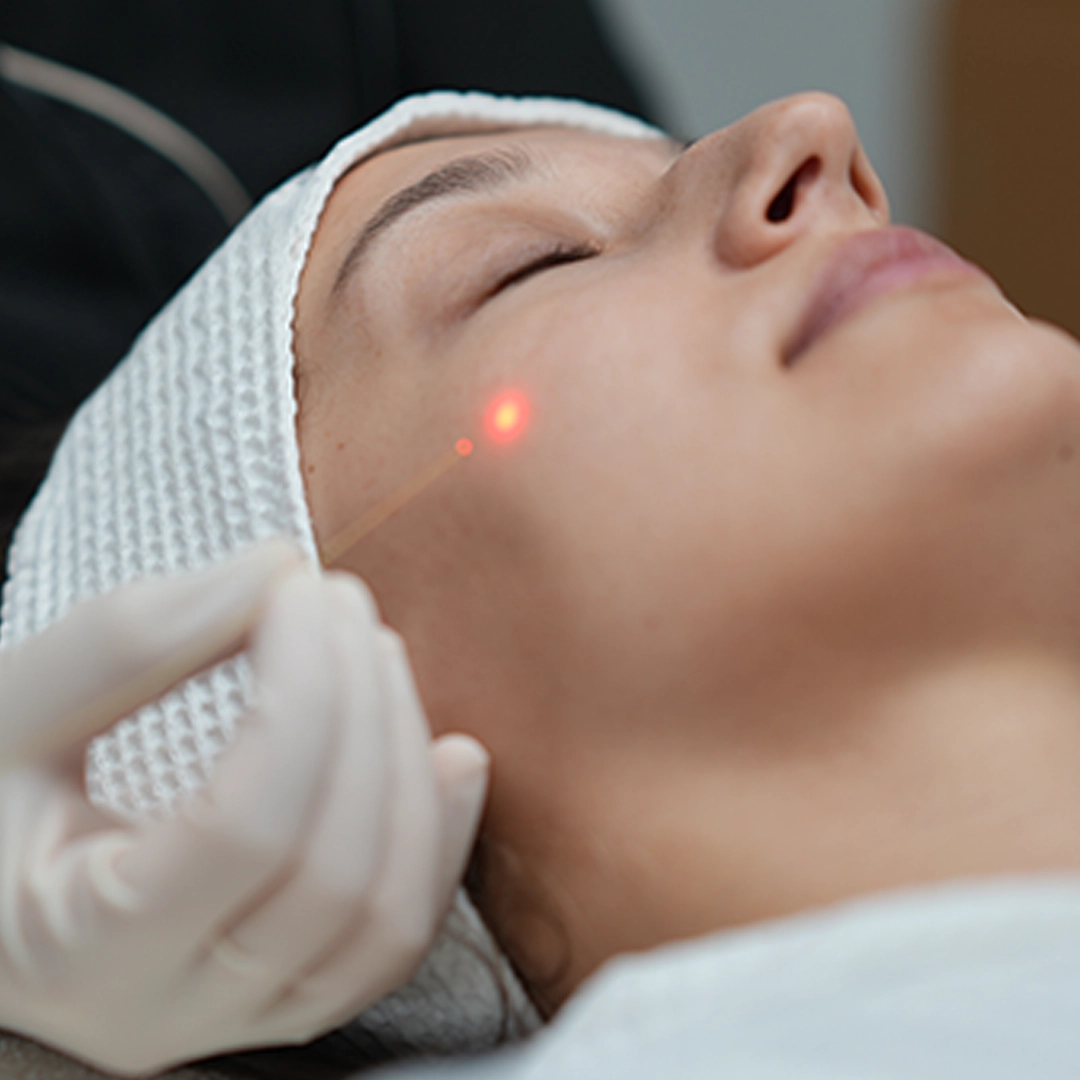 endolift lazer fiyat