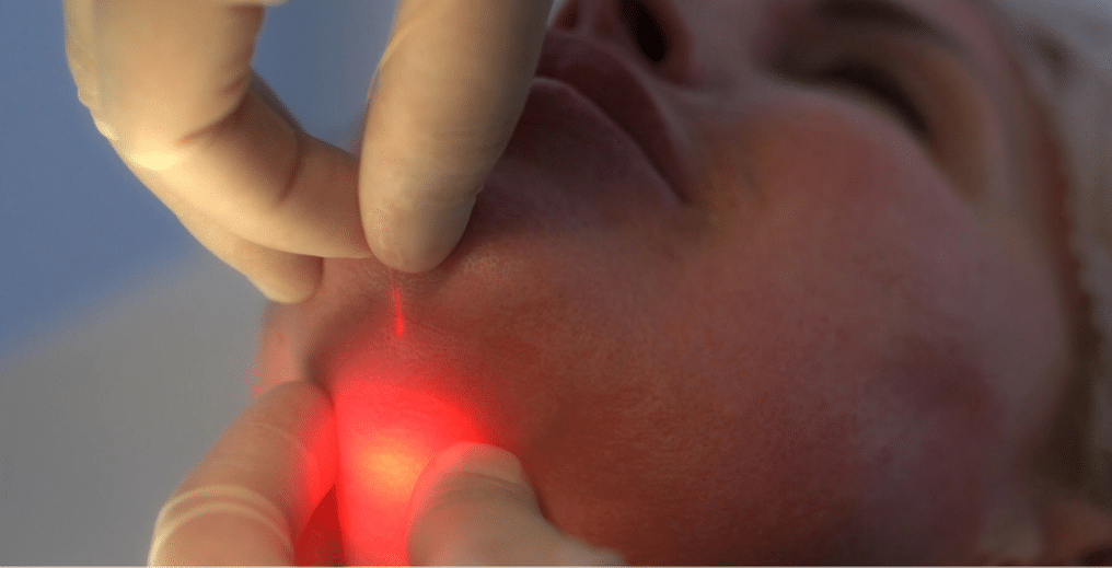 endolift lazer fiyatları